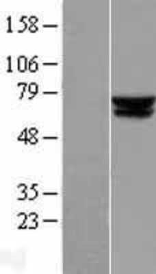 Western Blot: ACADVL Overexpression Lysate (Adult Normal) [NBL1-07223] Left-Empty vector transfected control cell lysate (HEK293 cell lysate); Right -Over-expression Lysate for ACADVL.