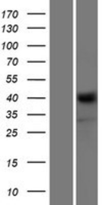Western Blot: NRXN1 Overexpression Lysate (Adult Normal) [NBL1-13805] Left-Empty vector transfected control cell lysate (HEK293 cell lysate); Right -Over-expression Lysate for NRXN1.