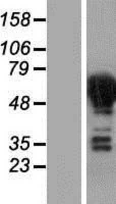 Western Blot: DPYSL4 Overexpression Lysate (Adult Normal) [NBP2-07621] Left-Empty vector transfected control cell lysate (HEK293 cell lysate); Right -Over-expression Lysate for DPYSL4.