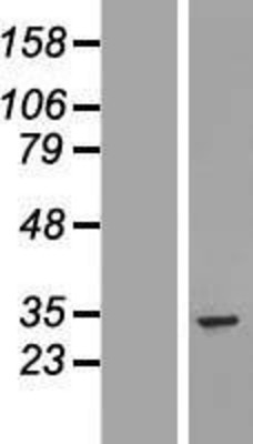 Western Blot: UTP11L Overexpression Lysate (Adult Normal) [NBL1-17676] Left-Empty vector transfected control cell lysate (HEK293 cell lysate); Right -Over-expression Lysate for UTP11L.