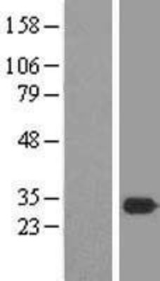 Western Blot: MEA1 Overexpression Lysate (Adult Normal) [NBL1-12976] Left-Empty vector transfected control cell lysate (HEK293 cell lysate); Right -Over-expression Lysate for MEA1.