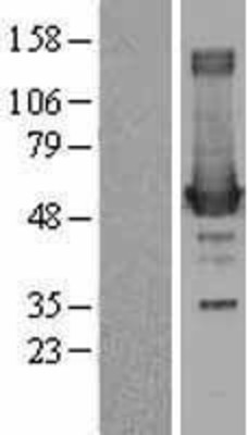 Western Blot: Ornithine Decarboxylase Overexpression Lysate (Adult Normal) [NBL1-13907] Left-Empty vector transfected control cell lysate (HEK293 cell lysate); Right -Over-expression Lysate for Ornithine Decarboxylase.