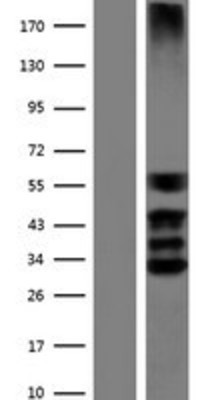 Western Blot: SOX3 Overexpression Lysate (Adult Normal) [NBP2-07720] Left-Empty vector transfected control cell lysate (HEK293 cell lysate); Right -Over-expression Lysate for SOX3.