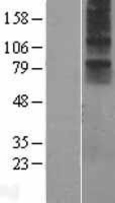 Western Blot: NMUR1 Overexpression Lysate (Adult Normal) [NBP2-07672] Left-Empty vector transfected control cell lysate (HEK293 cell lysate); Right -Over-expression Lysate for NMUR1.