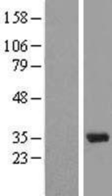Western Blot: U1A Overexpression Lysate (Adult Normal) [NBL1-16285] Left-Empty vector transfected control cell lysate (HEK293 cell lysate); Right -Over-expression Lysate for U1A.