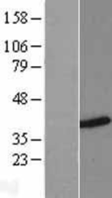 Western Blot: HNRPH3 Overexpression Lysate (Adult Normal) [NBL1-11644] Left-Empty vector transfected control cell lysate (HEK293 cell lysate); Right -Over-expression Lysate for HNRPH3.