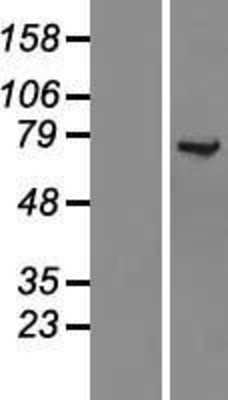 Western Blot: KLC1 Overexpression Lysate (Adult Normal) [NBL1-12308] Left-Empty vector transfected control cell lysate (HEK293 cell lysate); Right -Over-expression Lysate for KLC1.