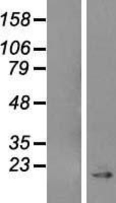 Western Blot: Caveolin 1 Overexpression Lysate (Adult Normal) [NBL1-08729] Left-Empty vector transfected control cell lysate (HEK293 cell lysate); Right -Over-expression Lysate for Caveolin 1.