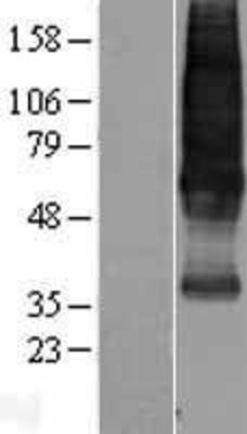 Western Blot: Somatostatin Receptor 1 Overexpression Lysate (Adult Normal) [NBL1-16477] Left-Empty vector transfected control cell lysate (HEK293 cell lysate); Right -Over-expression Lysate for Somatostatin Receptor 1.
