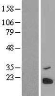 Western Blot: C6orf203 Overexpression Lysate (Adult Normal) [NBL1-08525] Left-Empty vector transfected control cell lysate (HEK293 cell lysate); Right -Over-expression Lysate for C6orf203.