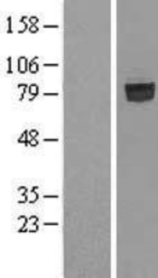 Western Blot: SHCBP1 Overexpression Lysate (Adult Normal) [NBL1-15938] Left-Empty vector transfected control cell lysate (HEK293 cell lysate); Right -Over-expression Lysate for SHCBP1.