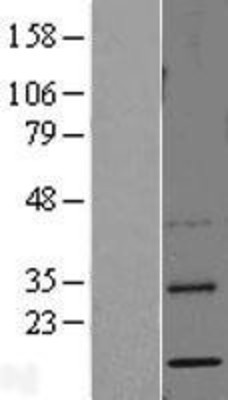 Western Blot: GRO2 Overexpression Lysate (Adult Normal) [NBL1-09627] Left-Empty vector transfected control cell lysate (HEK293 cell lysate); Right -Over-expression Lysate for GRO2.