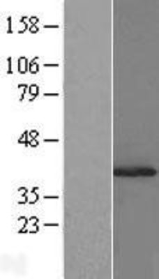 Western Blot: SUGT1 Overexpression Lysate (Adult Normal) [NBL1-16598] Left-Empty vector transfected control cell lysate (HEK293 cell lysate); Right -Over-expression Lysate for SUGT1.