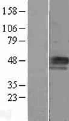 Western Blot: Cyclin E Overexpression Lysate (Adult Normal) [NBL1-08876] Left-Empty vector transfected control cell lysate (HEK293 cell lysate); Right -Over-expression Lysate for Cyclin E.