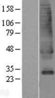 Western Blot: SLC39A9/ZIP9 Overexpression Lysate (Adult Normal) [NBL1-16152] Left-Empty vector transfected control cell lysate (HEK293 cell lysate); Right -Over-expression Lysate for SLC39A9/ZIP9.