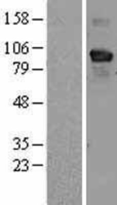 Western Blot: RBM5 Overexpression Lysate (Adult Normal) [NBL1-15215] Left-Empty vector transfected control cell lysate (HEK293 cell lysate); Right -Over-expression Lysate for RBM5.