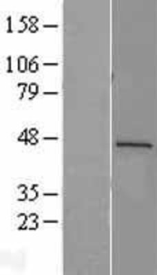 Western Blot: Renin Overexpression Lysate (Adult Normal) [NBL1-15280] Left-Empty vector transfected control cell lysate (HEK293 cell lysate); Right -Over-expression Lysate for Renin.