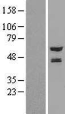 Western Blot: NMT2 Overexpression Lysate (Adult Normal) [NBL1-13695] Left-Empty vector transfected control cell lysate (HEK293 cell lysate); Right -Over-expression Lysate for NMT2.