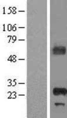 Western Blot: APIP Overexpression Lysate (Adult Normal) [NBL1-07603] Left-Empty vector transfected control cell lysate (HEK293 cell lysate); Right -Over-expression Lysate for APIP.