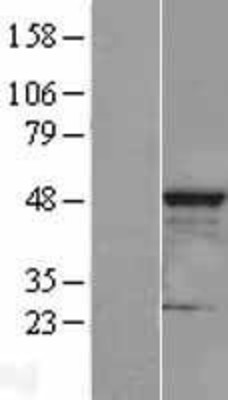 Western Blot: CLP1 Overexpression Lysate (Adult Normal) [NBL1-09277] Left-Empty vector transfected control cell lysate (HEK293 cell lysate); Right -Over-expression Lysate for CLP1.