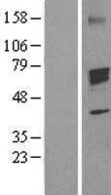 Western Blot: Aromatase Overexpression Lysate (Adult Normal) [NBL1-09674] Left-Empty vector transfected control cell lysate (HEK293 cell lysate); Right -Over-expression Lysate for Aromatase.