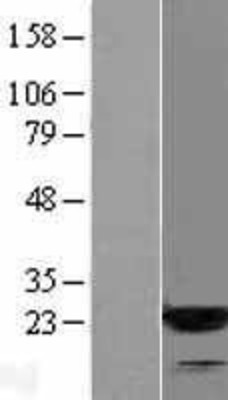 Western Blot: ARF3 Overexpression Lysate (Adult Normal) [NBL1-07651] Left-Empty vector transfected control cell lysate (HEK293 cell lysate); Right -Over-expression Lysate for ARF3.