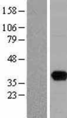 Western Blot: uracil-DNA glycosylase Overexpression Lysate (Adult Normal) [NBL1-17620] Left-Empty vector transfected control cell lysate (HEK293 cell lysate); Right -Over-expression Lysate for uracil-DNA glycosylase.