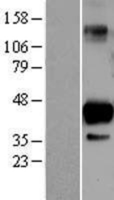 Western Blot: SIRT6 Overexpression Lysate (Adult Normal) [NBL1-15979] Left-Empty vector transfected control cell lysate (HEK293 cell lysate); Right -Over-expression Lysate for SIRT6.