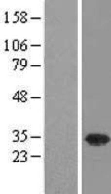 Western Blot: USF1 Overexpression Lysate (Adult Normal) [NBL1-17637] Left-Empty vector transfected control cell lysate (HEK293 cell lysate); Right -Over-expression Lysate for USF1.