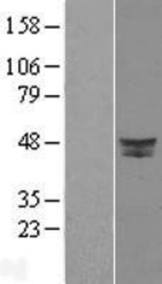 Western Blot: DPF2 Overexpression Lysate (Adult Normal) [NBL1-09989] Left-Empty vector transfected control cell lysate (HEK293 cell lysate); Right -Over-expression Lysate for DPF2.