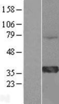 Western Blot: HMGCL Overexpression Lysate (Adult Normal) [NBL1-11617] Left-Empty vector transfected control cell lysate (HEK293 cell lysate); Right -Over-expression Lysate for HMGCL.