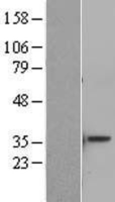 Western Blot: ATF5 Overexpression Lysate (Adult Normal) [NBL1-07792] Left-Empty vector transfected control cell lysate (HEK293 cell lysate); Right -Over-expression Lysate for ATF5.