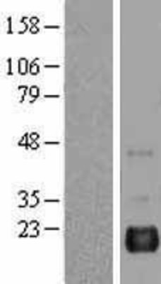 Western Blot: BAALC Overexpression Lysate (Adult Normal) [NBL1-07894] Left-Empty vector transfected control cell lysate (HEK293 cell lysate); Right -Over-expression Lysate for BAALC.