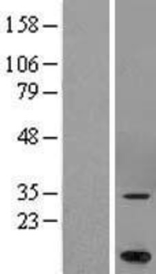 Western Blot: MARCH5 Overexpression Lysate (Adult Normal) [NBL1-07000] Left-Empty vector transfected control cell lysate (HEK293 cell lysate); Right -Over-expression Lysate for MARCH5.