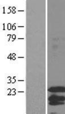 Western Blot: Factor VIII Overexpression Lysate (Adult Normal) [NBL1-10413] Left-Empty vector transfected control cell lysate (HEK293 cell lysate); Right -Over-expression Lysate for Factor VIII.