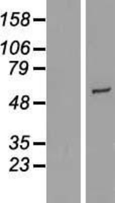 Western Blot: CYP2R1 Overexpression Lysate (Adult Normal) [NBL1-09689] Left-Empty vector transfected control cell lysate (HEK293 cell lysate); Right -Over-expression Lysate for CYP2R1.
