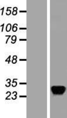Western Blot: RASD2 Overexpression Lysate (Adult Normal) [NBL1-15169] Left-Empty vector transfected control cell lysate (HEK293 cell lysate); Right -Over-expression Lysate for RASD2.