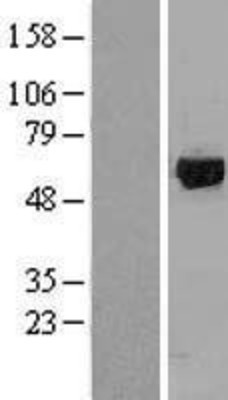Western Blot: GRK1 Overexpression Lysate (Adult Normal) [NBL1-11342] Left-Empty vector transfected control cell lysate (HEK293 cell lysate); Right -Over-expression Lysate for GRK1.