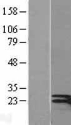 Western Blot: Interferon gamma Overexpression Lysate (Adult Normal) [NBL1-11851] Left-Empty vector transfected control cell lysate (HEK293 cell lysate); Right -Over-expression Lysate for Interferon gamma.