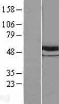 Western Blot: beta Tubulin Overexpression Lysate (Adult Normal) [NBL1-17435] Left-Empty vector transfected control cell lysate (HEK293 cell lysate); Right -Over-expression Lysate for beta Tubulin.
