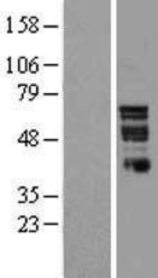 Western Blot: Nurr1 Overexpression Lysate (Adult Normal) [NBL1-13780] Left-Empty vector transfected control cell lysate (HEK293 cell lysate); Right -Over-expression Lysate for Nurr1.