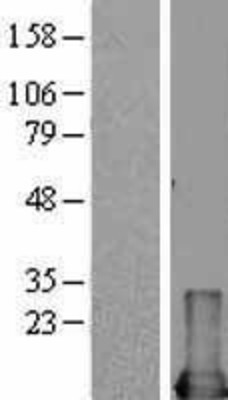 Western Blot: MIF Overexpression Lysate (Adult Normal) [NBL1-13108] Left-Empty vector transfected control cell lysate (HEK293 cell lysate); Right -Over-expression Lysate for MIF.