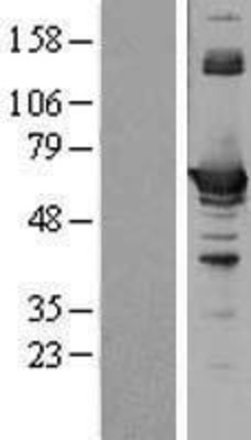 Western Blot: CBS Overexpression Lysate (Adult Normal) [NBL1-08744] Left-Empty vector transfected control cell lysate (HEK293 cell lysate); Right -Over-expression Lysate for CBS.
