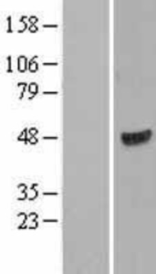 Western Blot: WIPI1 Overexpression Lysate (Adult Normal) [NBL1-17853] Left-Empty vector transfected control cell lysate (HEK293 cell lysate); Right -Over-expression Lysate for WIPI1.