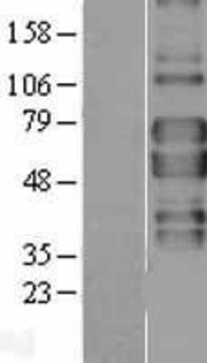Western Blot: TNF Receptor II Overexpression Lysate (Adult Normal) [NBL1-17155] Left-Empty vector transfected control cell lysate (HEK293 cell lysate); Right -Over-expression Lysate for TNF Receptor II.