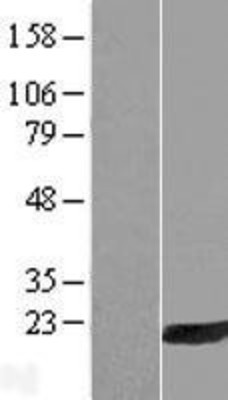 Western Blot: HRASLS3 Overexpression Lysate (Adult Normal) [NBL1-11704] Left-Empty vector transfected control cell lysate (HEK293 cell lysate); Right -Over-expression Lysate for HRASLS3.