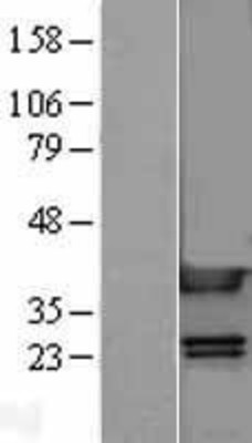 Western Blot: HMGB1 Overexpression Lysate (Adult Normal) [NBL1-11614] Left-Empty vector transfected control cell lysate (HEK293 cell lysate); Right -Over-expression Lysate for HMGB1.