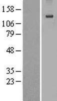 Western Blot: EGF Overexpression Lysate (Adult Normal) [NBL1-10149] Left-Empty vector transfected control cell lysate (HEK293 cell lysate); Right -Over-expression Lysate for EGF.
