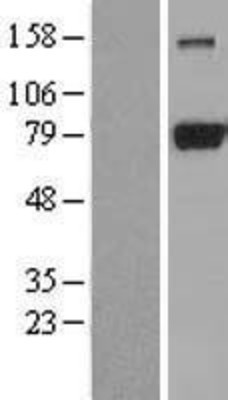 Western Blot: DRP1 Overexpression Lysate (Adult Normal) [NBL1-09967] Left-Empty vector transfected control cell lysate (HEK293 cell lysate); Right -Over-expression Lysate for DRP1.