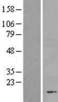 Western Blot: C13orf30 Overexpression Lysate (Adult Normal) [NBL1-08162] Left-Empty vector transfected control cell lysate (HEK293 cell lysate); Right -Over-expression Lysate for C13orf30.
